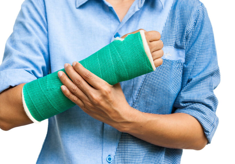 Green cast on an arm of a women isolated on white background